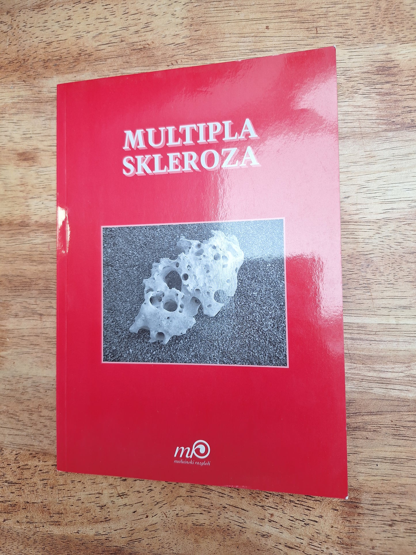 Multipla skleroza Medicinski razgledi